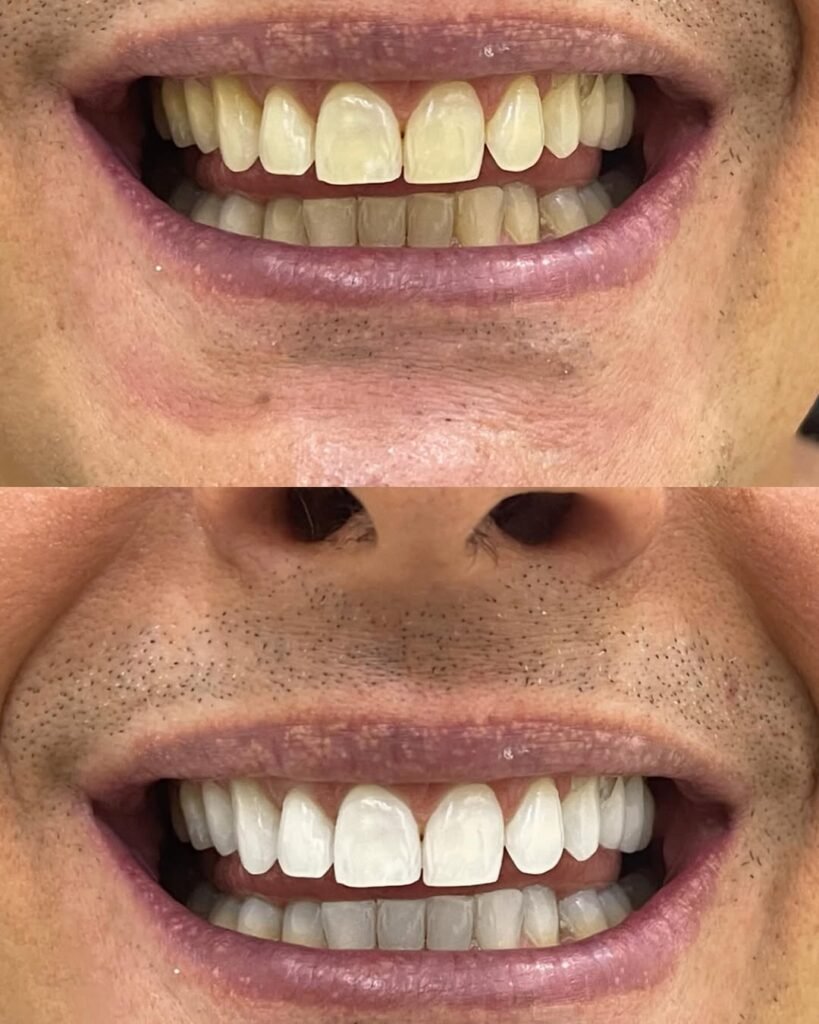 resultados-clinicos-2